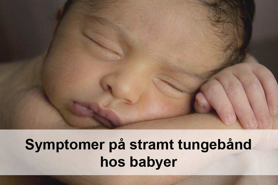 Symptomer på tungebånd hos baby, børn og voksne